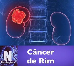 Câncer de Rim
