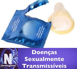 Doenças Sexualmente Transmissíveis